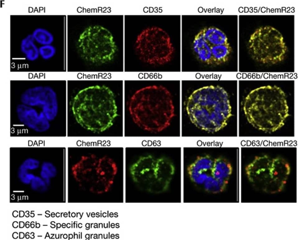 Detection of ChemR23/CMKLR1 by Immunocytochemistry/ Immunofluorescence