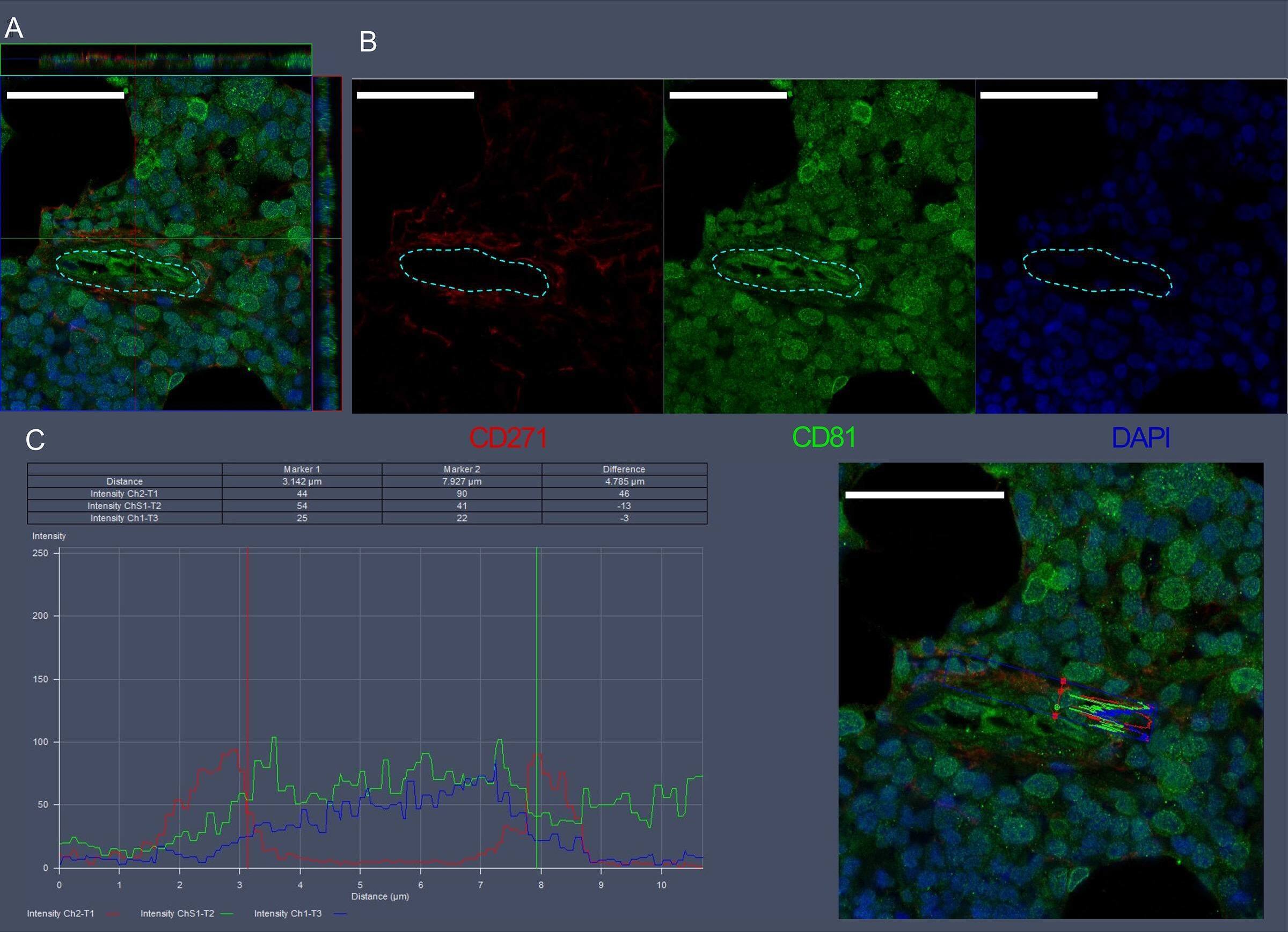 Detection of NGFR/TNFRSF16 by Immunohistochemistry