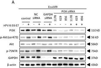 Detection of NGFR/TNFRSF16 by Western Blot