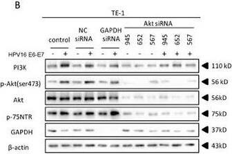 Detection of NGFR/TNFRSF16 by Western Blot