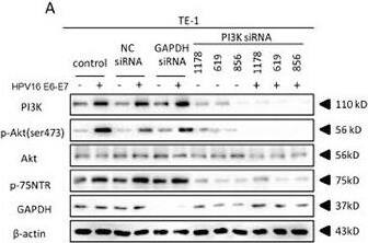 Detection of NGFR/TNFRSF16 by Western Blot