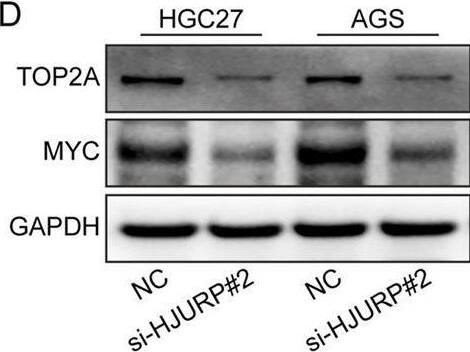 Detection of c-Myc by Western Blot