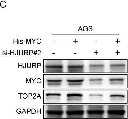 Detection of c-Myc by Western Blot