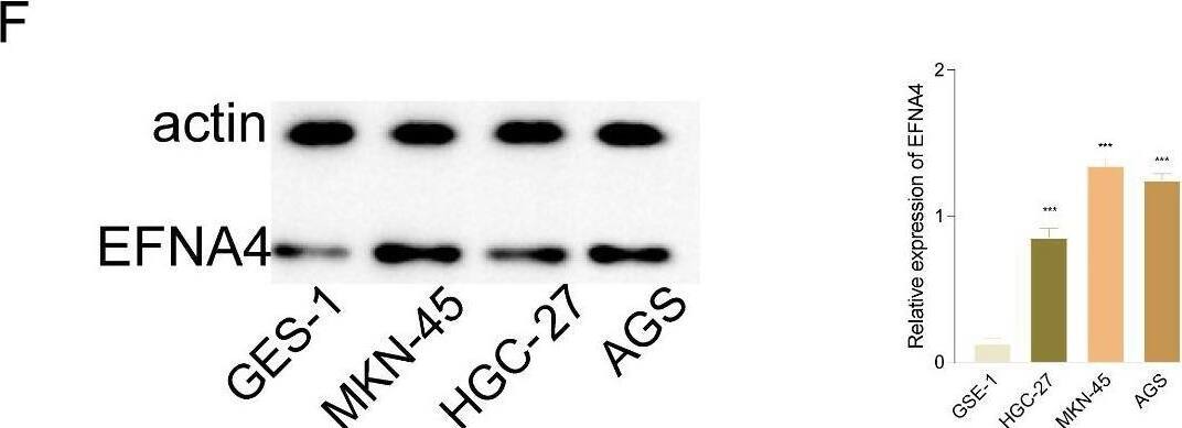 Detection of Human Ephrin-A4 by Western Blot