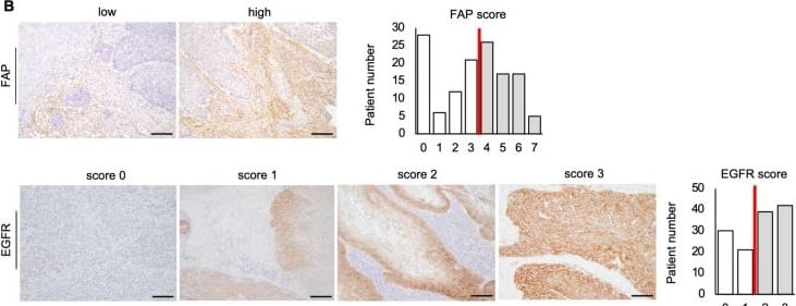 Detection of Fibroblast Activation Protein alpha /FAP by Immunohistochemistry