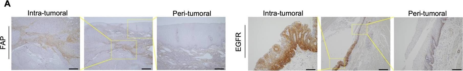 Detection of Fibroblast Activation Protein alpha /FAP by Immunohistochemistry