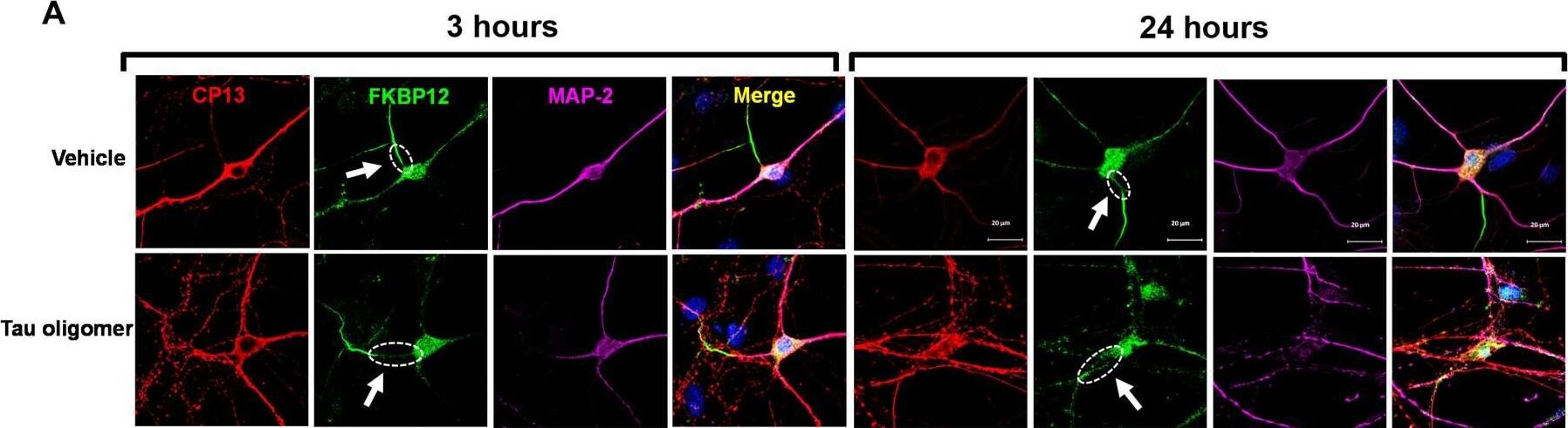 Detection of Mouse FKBP12 by Immunocytochemistry/ Immunofluorescence