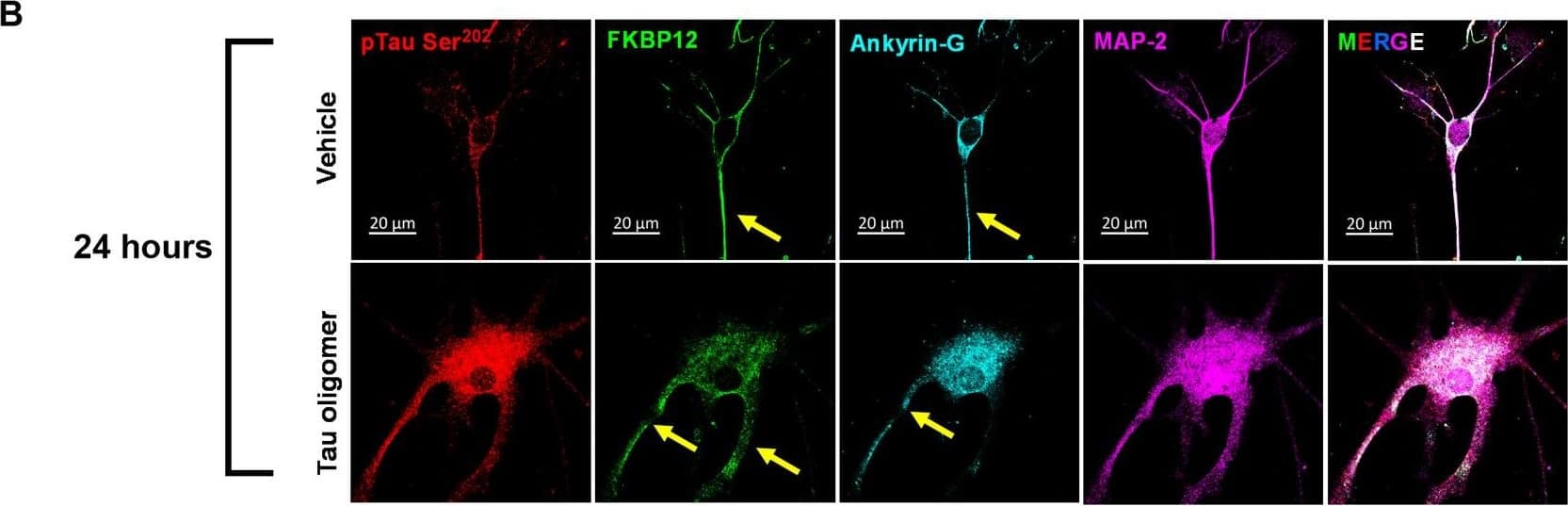 Detection of Mouse FKBP12 by Immunocytochemistry/ Immunofluorescence