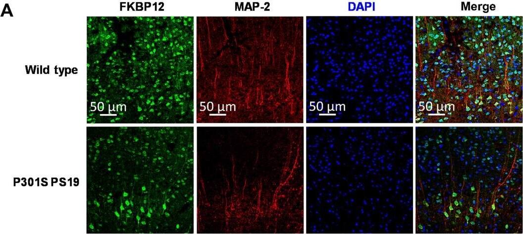 Detection of Mouse FKBP12 by Immunohistochemistry