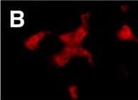 Detection of Human CD4 by Immunocytochemistry/Immunofluorescence