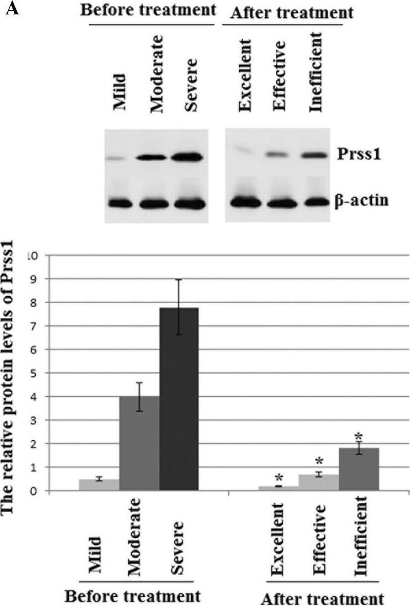 Detection of Human Trypsin 1/PRSS1 by Western Blot
