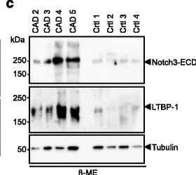 Detection of Latent TGF&iquest; beta bp1 by Western Blot