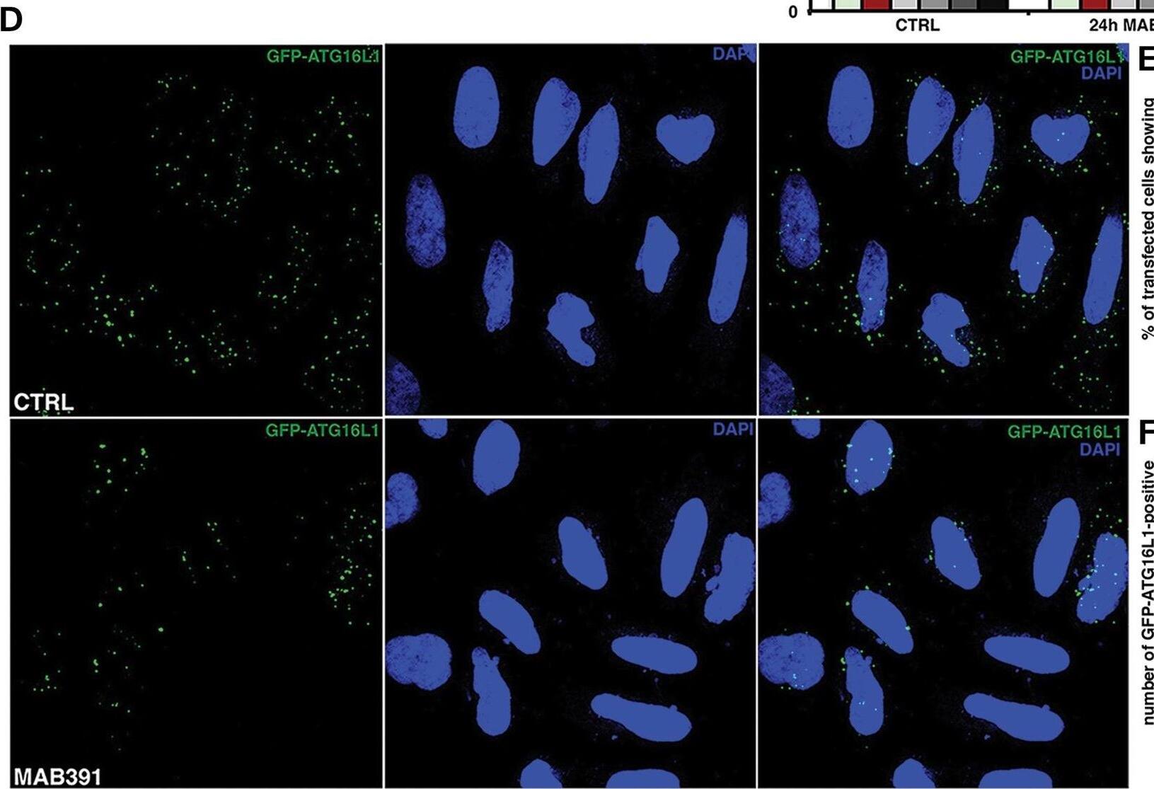 Detection of IGF-I R/IGF1R by Immunocytochemistry/ Immunofluorescence