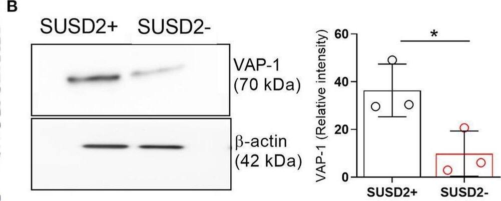 Detection of VAP-1/AOC3 by Western Blot