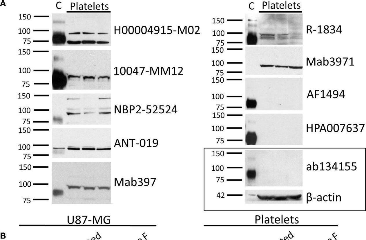 Detection of TrkB by Western Blot