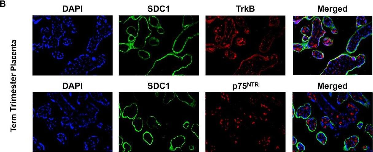 Detection of Human TrkB by Immunohistochemistry Detection of Human TrkB by Immunohistochemistry