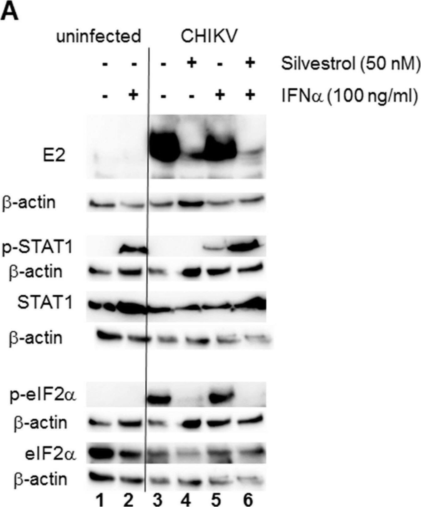Detection of Phospho-eIF2 alpha (S52) by Western Blot