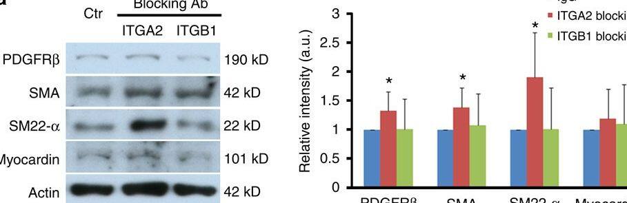 Detection of Mouse Myocardin by Western Blot