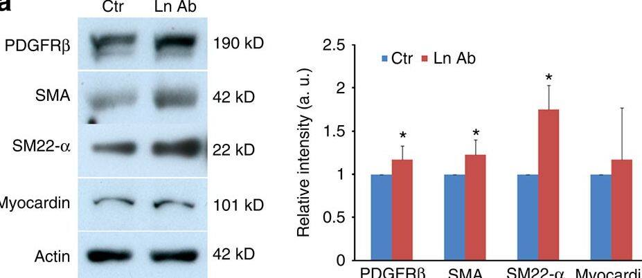 Detection of Mouse Myocardin by Western Blot