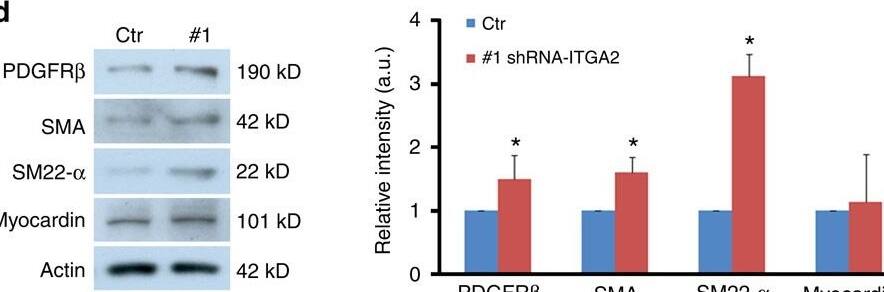 Detection of Mouse Myocardin by Western Blot