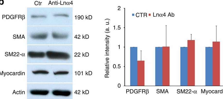 Detection of Mouse Myocardin by Western Blot