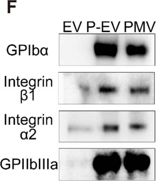 Detection of Human CD42b/GPIb alpha by Western Blot