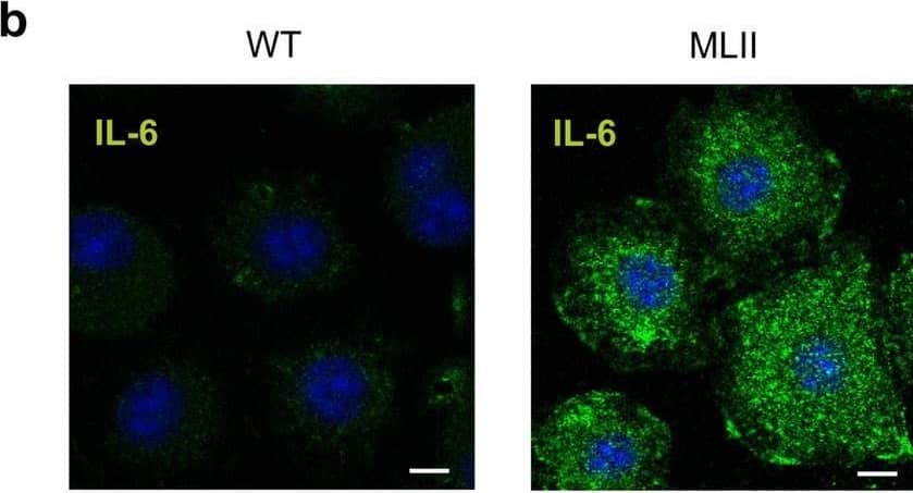Detection of IL-6 by Immunocytochemistry/ Immunofluorescence