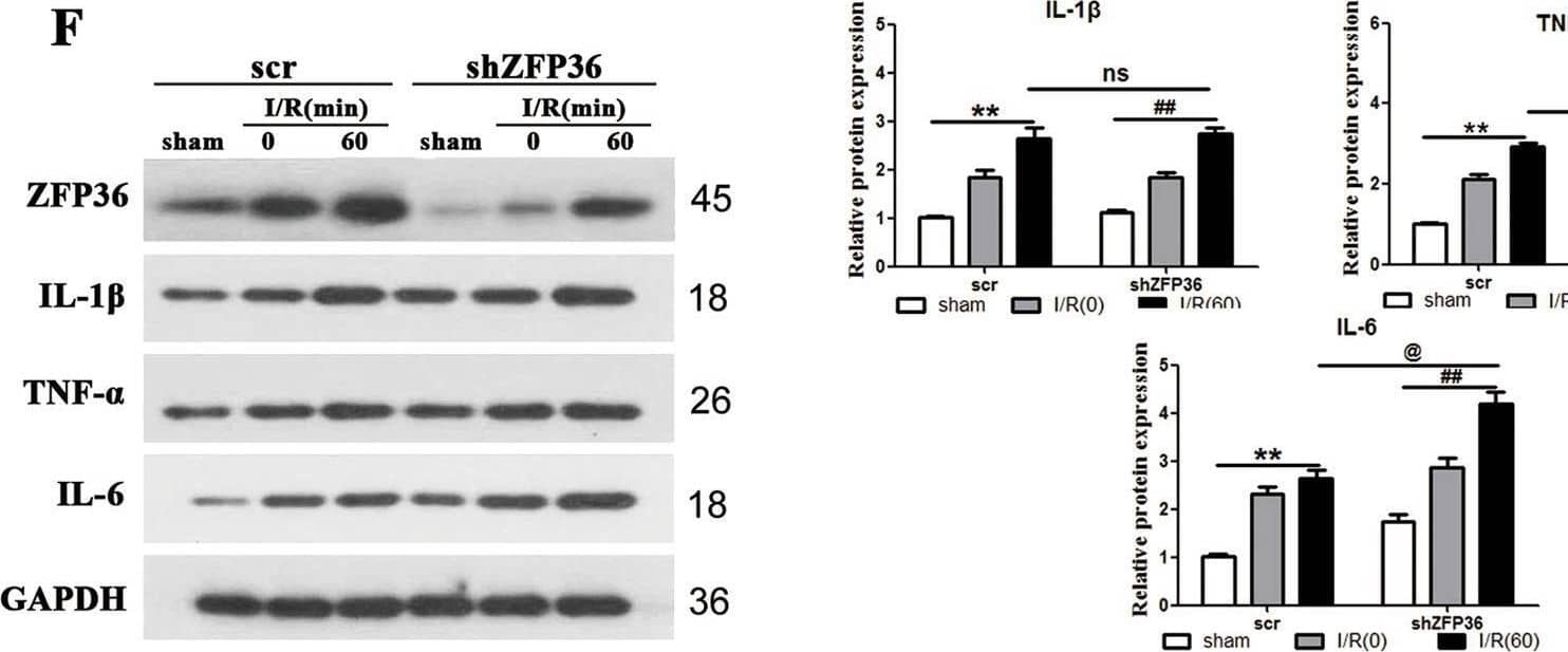Detection of IL-6 by Western Blot