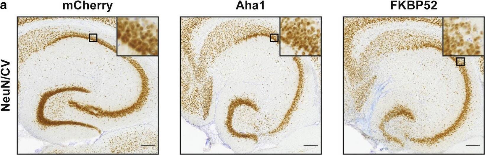 Detection of FKBP52 by Immunohistochemistry