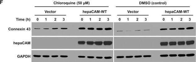 Detection of Human HepaCAM by Western Blot