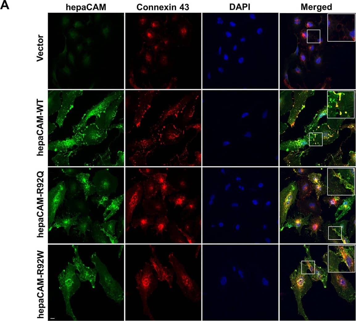 Detection of Human HepaCAM by Immunocytochemistry/Immunofluorescence