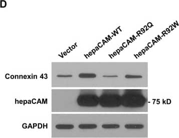 Detection of Human HepaCAM by Western Blot