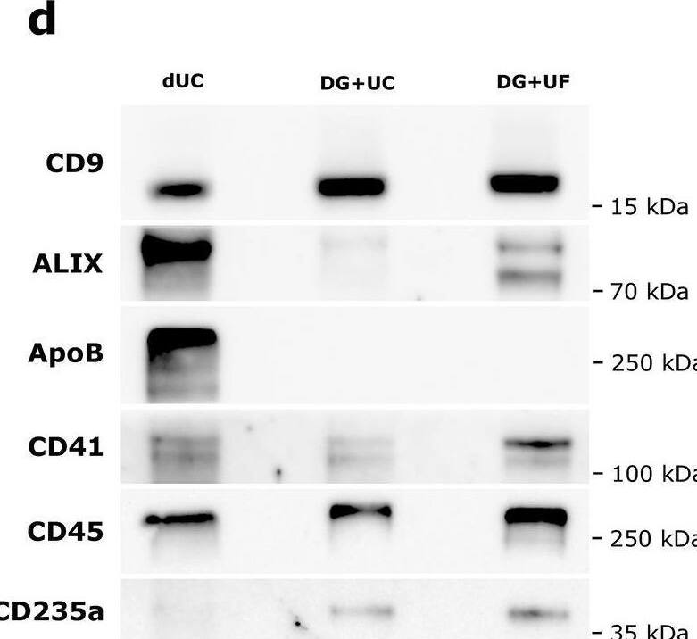 Detection of Apolipoprotein B/ApoB by Western Blot
