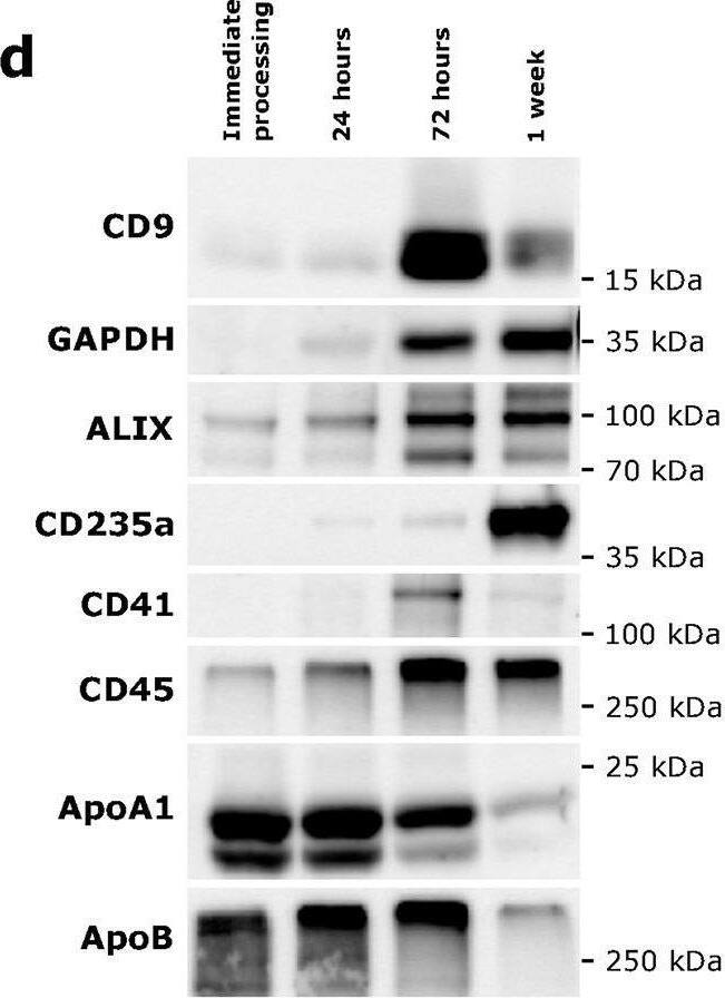 Detection of Apolipoprotein B/ApoB by Western Blot