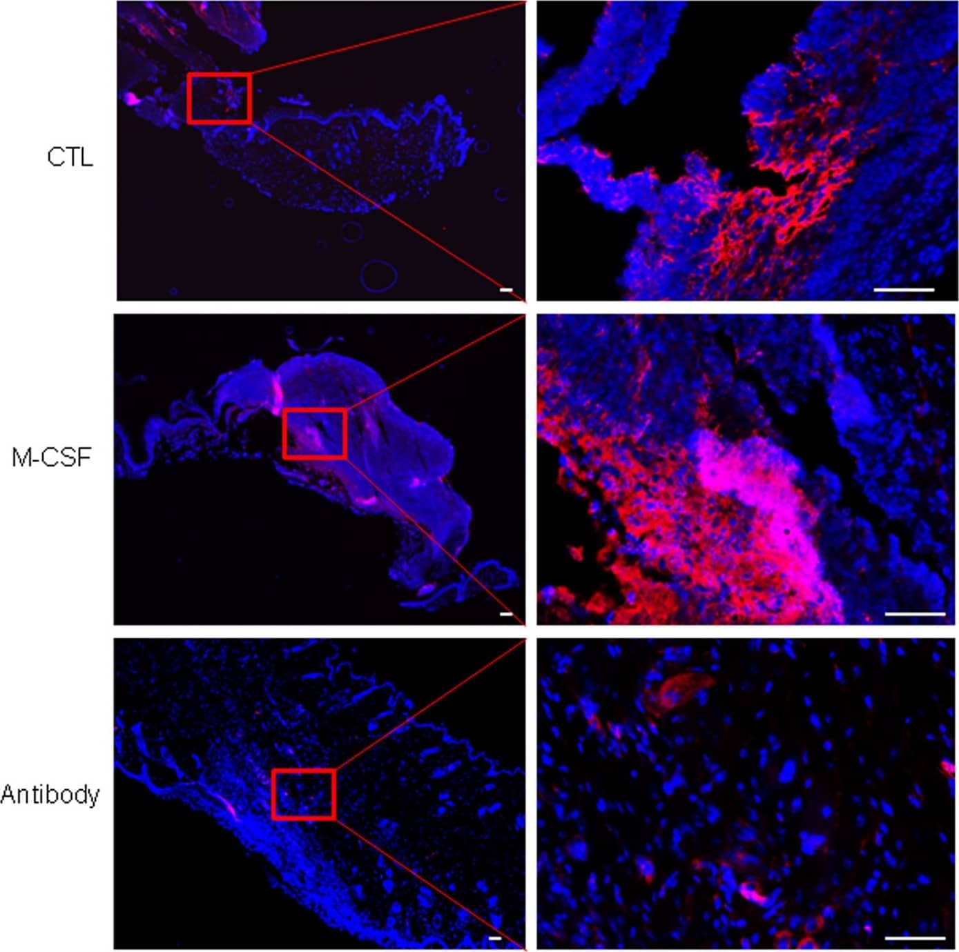 Detection of Mouse M-CSF by Immunocytochemistry/Immunofluorescence