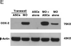 Detection of Human COX-2 by Western Blot
