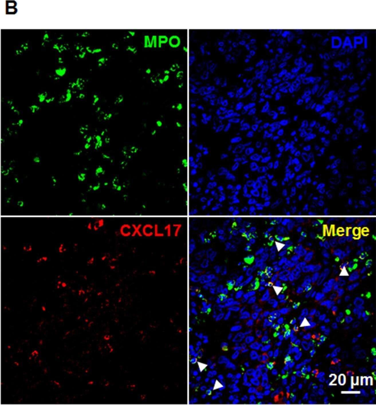 Detection of CXCL17/VCC-1 by Immunohistochemistry