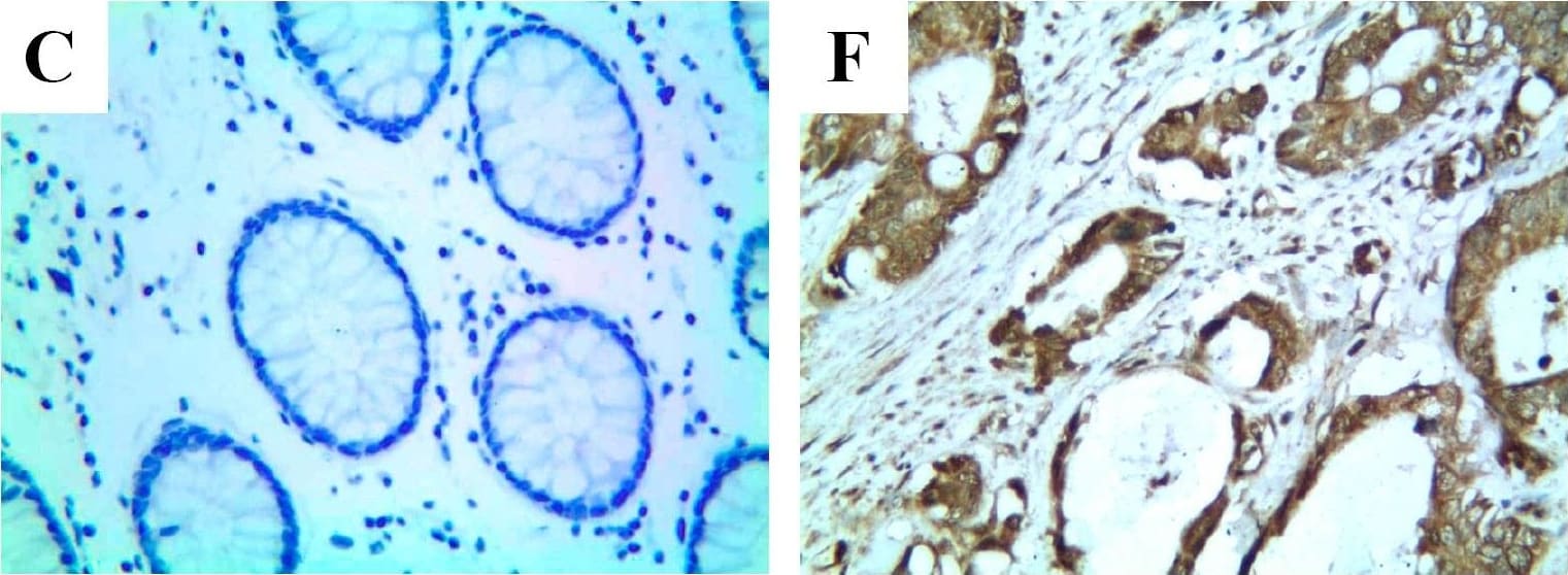 Detection of Human CXCR7/RDC-1 by Immunocytochemistry/Immunofluorescence