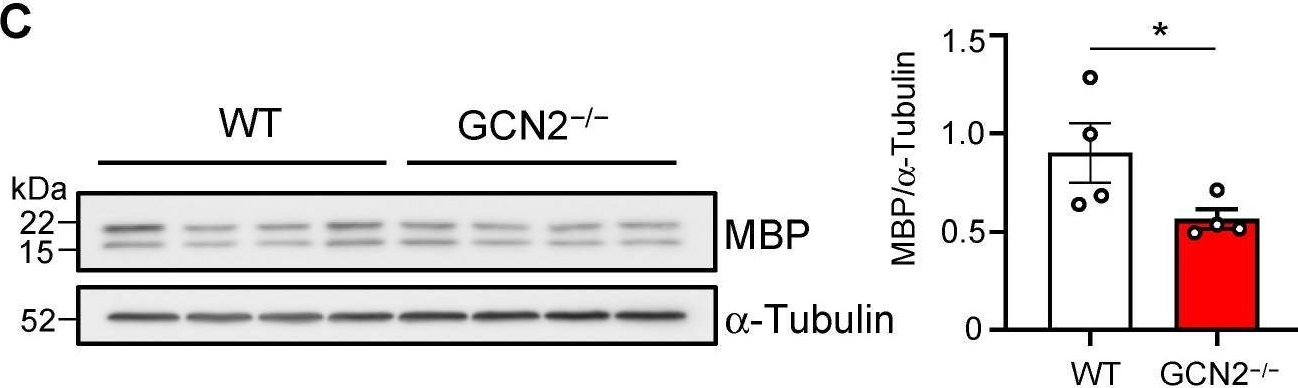 Detection of MBP by Western Blot