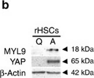 Detection of Mouse Integrin alpha 11 by Western Blot