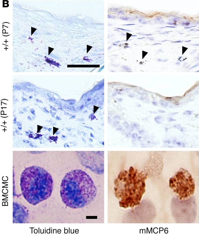 Detection of Mast Cell Protease-6/Mcpt6 by Immunohistochemistry