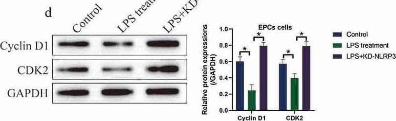 Detection of Cyclin D1 by Western Blot