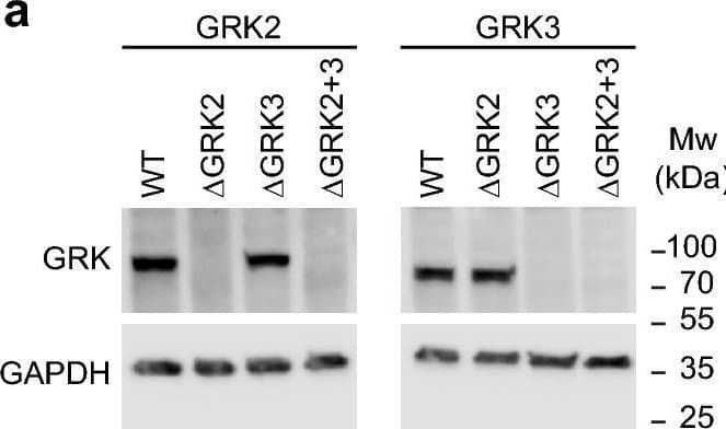 Detection of GRK2 by Western Blot