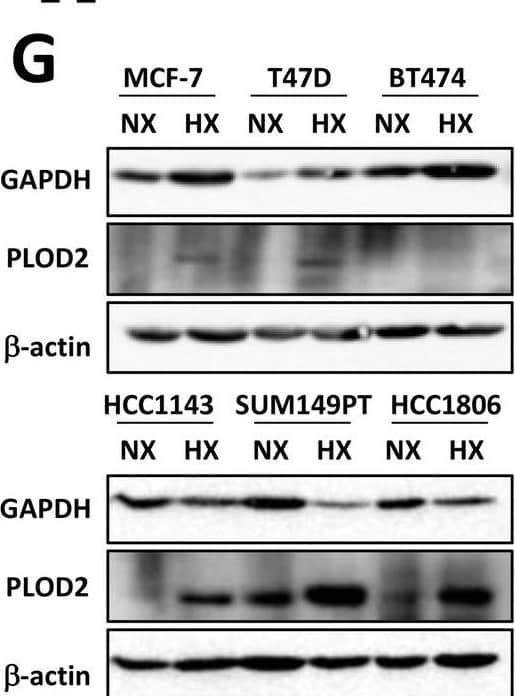 Detection of Lysine Hydroxylase 2/PLOD2 by Western Blot
