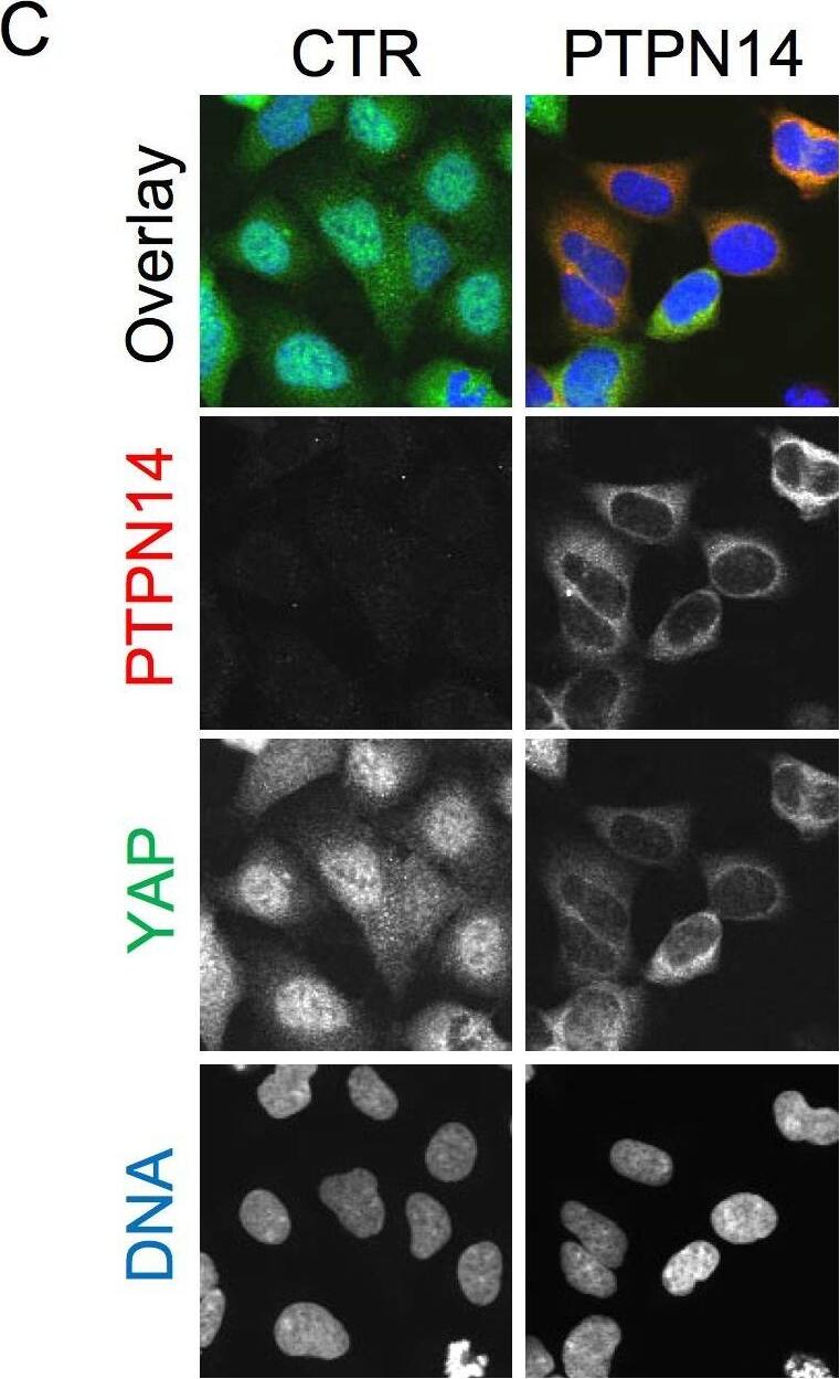 Detection of Human PTPN14/PTPD2 by Immunocytochemistry/ Immunofluorescence