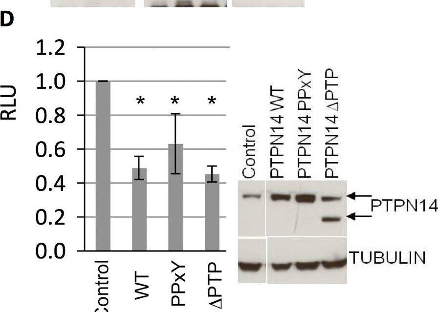 Detection of Human PTPN14/PTPD2 by Western Blot