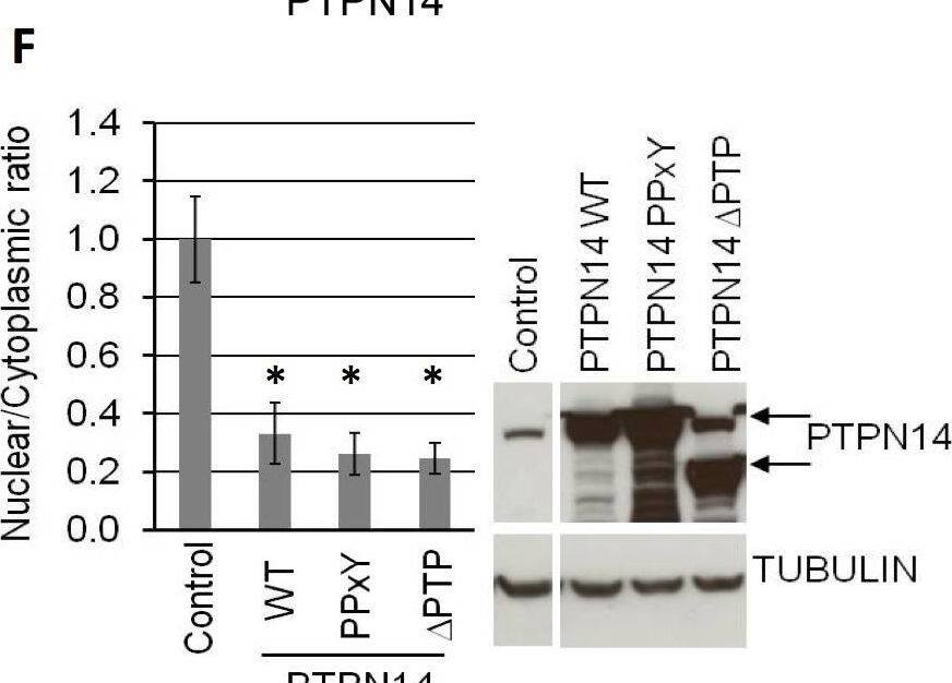 Detection of Human PTPN14/PTPD2 by Western Blot
