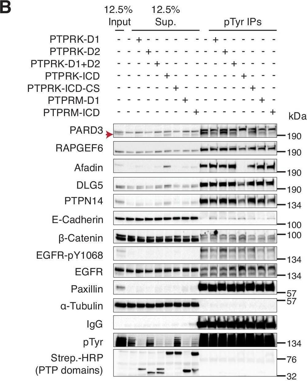 Detection of Human PTPN14/PTPD2 by Western Blot