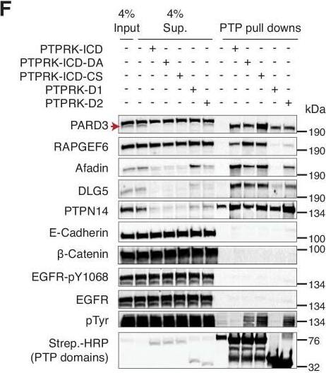 Detection of Human PTPN14/PTPD2 by Western Blot
