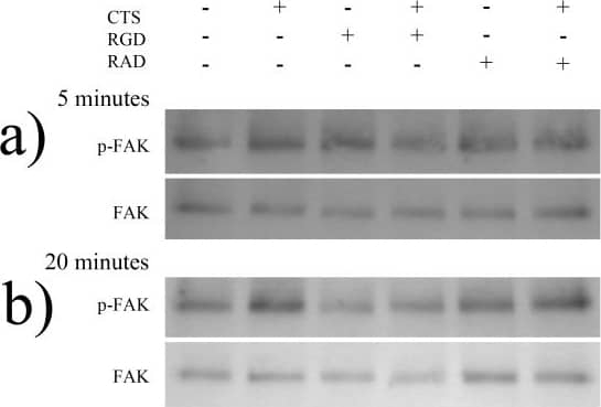 Detection of Human FAK by Western Blot